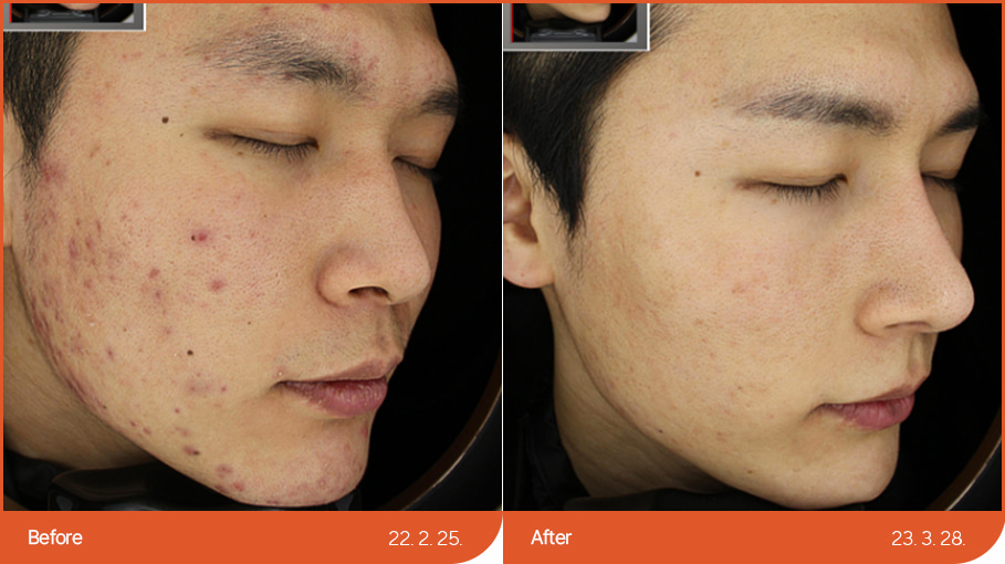 See before & after 2