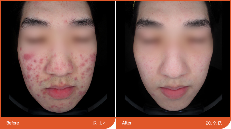 See before & after 1