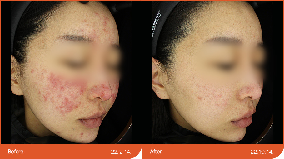 See before & after 3